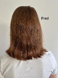 příloha