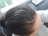 příloha